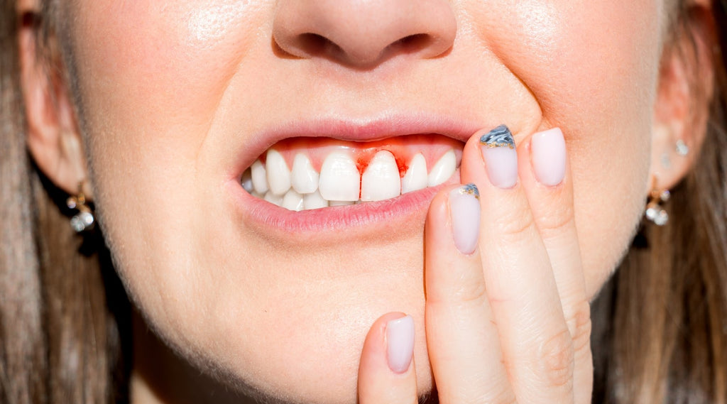 5 warning signs of gum disease - truthpaste