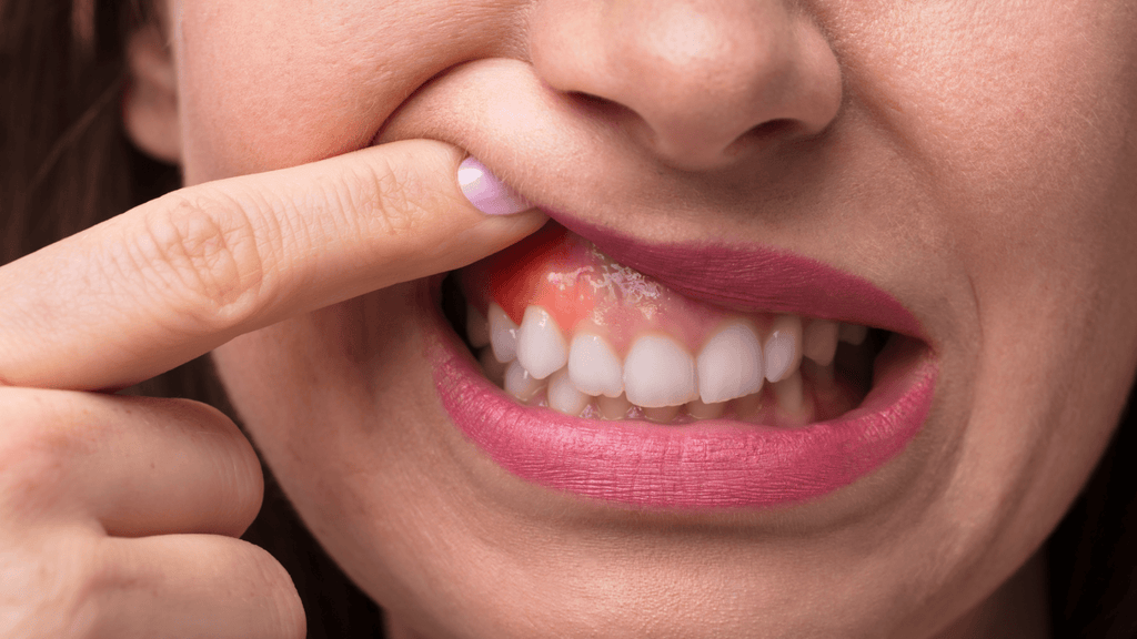 Does Truthpaste Help With Receding Gums? - truthpaste