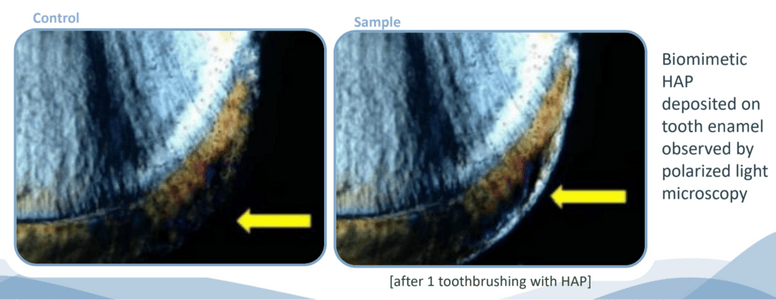 Enamel Repair Duo - truthpaste